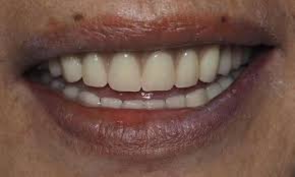 10,000 Jamaicans to benefit from new oral health programme